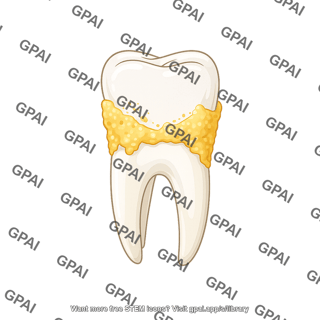 Tooth molar with plaque