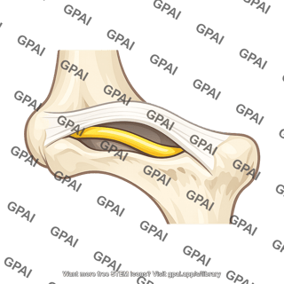 Cubital tunnel