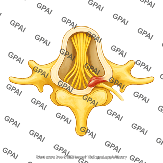 Cauda equina with pinched spinal nerve  cross section l5 superior