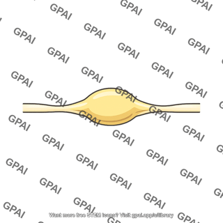 Ganglion spinal