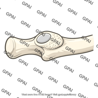 Tubercle of rib