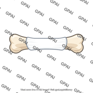 Bandaged bone