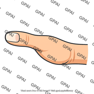 Thumb extended