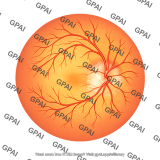 Eye retina naion 195