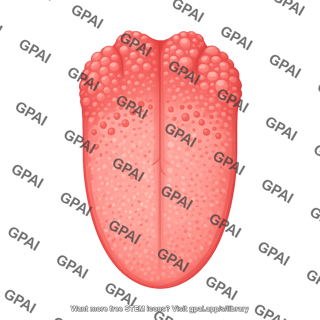 Tongue 470