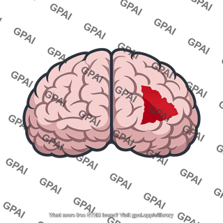Stroke