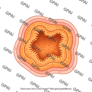 Intestine cross section ileum