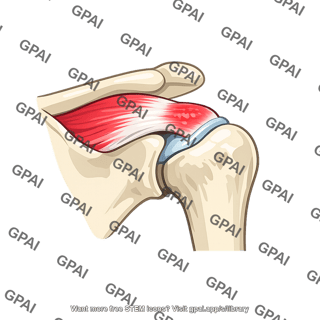 Rotator cuff tendinitis