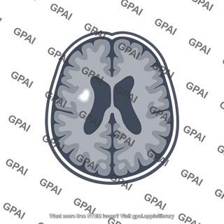 Periventricular lesion