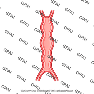 Linear heart tube human