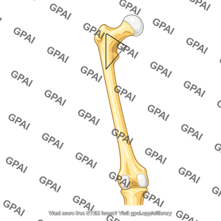 Femur anterior coxa vara with neck angle
