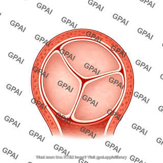 Aortic valve closed