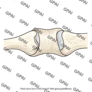 Capsule of joint of head of rib