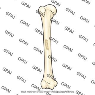 Medial humeral roughening