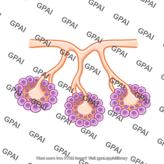 Pancreatic ductal gland 2 500