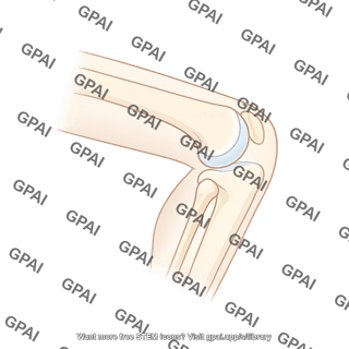 Knee lateral silhouette