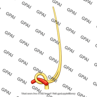 Right recurrent laryngeal nerve