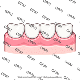 Gingiva