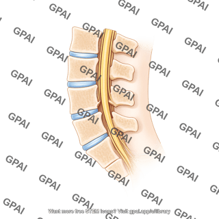 Spina bifidia occulta