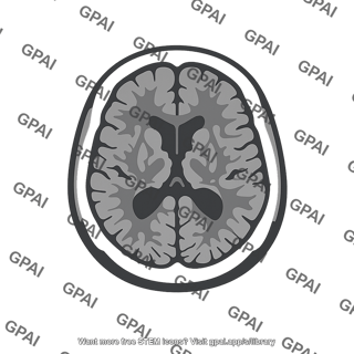 Cerebral ct scan