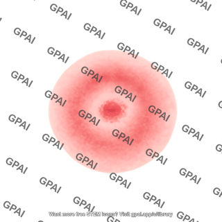 Erythema migrans rash