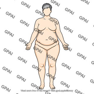 Adult female stage iii abdominal obesity 982