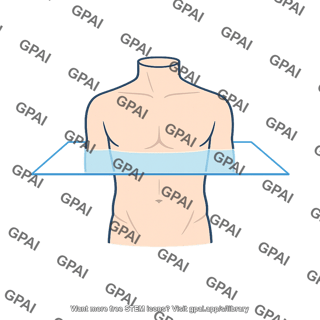 Transverse plane