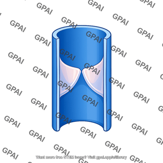 Vein valve