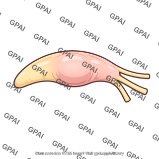 Trigeminal ganglion crescent