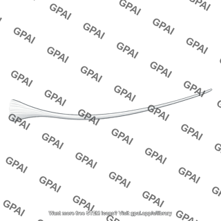 Stapedius tendon