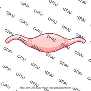 Uterine tube ampulla