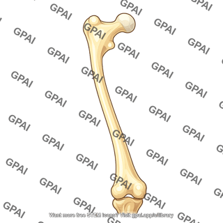 Femur anterior coxa vara 395
