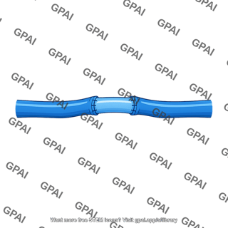 Venous anastomosis