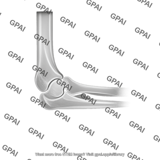 Radiograph lateral elbow