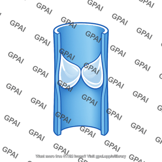 Venous valve