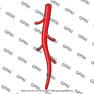 Branched artery