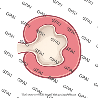 Renal sinus
