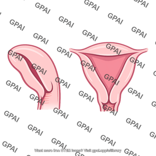 Uterine cavity
