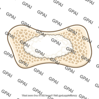 Sanitary pad