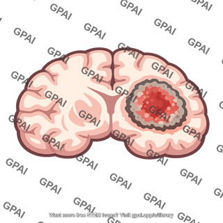 Brain lesion