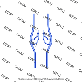 Venous valve open