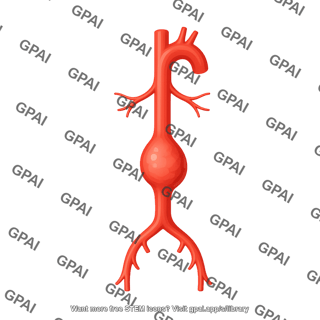 Aorta with aneurysm