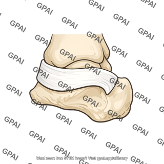 Inferior fibular retinaculum
