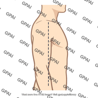 Midaxillary line