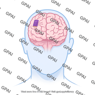 Human brain chip implant brain computer interface 805