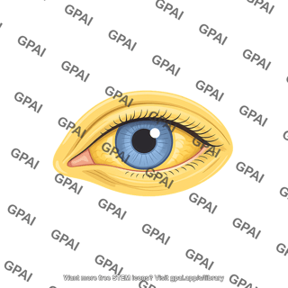 Jaundice eye