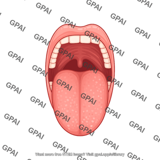 Mouth open mallampati score class 4