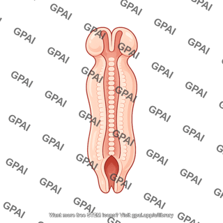 Neural tube 28 days spina bifida