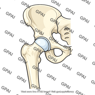 Hip