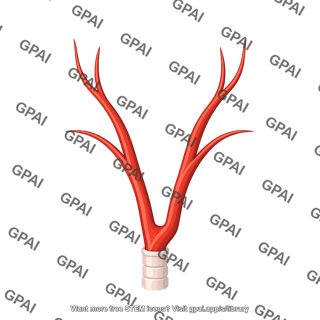 Carotid arteries
